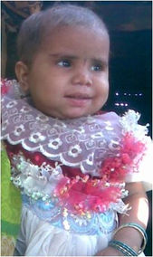 Lakshmi After Treatment