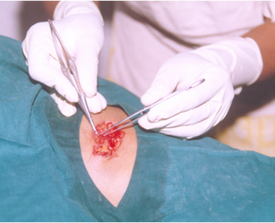 Bear bite treatment